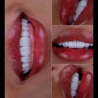 افر ۵۰ درصد کامپوزیت دندان با اصالت و گارانتی کالا