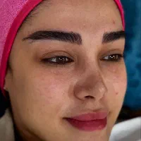 فیشال تخصصی زیر نظر پزشک