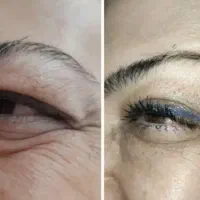 اموزش خدمات پلاسما کک ومک لک خال مزو کرمپودردائم|خدمات آرایشگری و زیبایی|قم, زنبیل آباد|دیوار