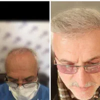 کلینیک کاشت واحیای مو