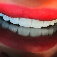 جرمگیری و کامپوزیت