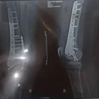 نیازفوری به ۱۰ ملیون پول دارم|فعالیت داوطلبانه تحقیقاتی|تبریز, |دیوار