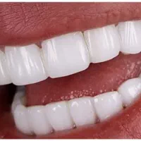 کامپوزیت دندان