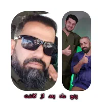 کاشت تخصصی مو در شهر بابل