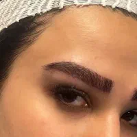 کاشت تخصصی ابرو