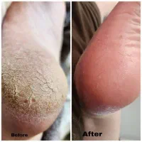 مدل پدیکور خیس کفسابی پا