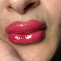 شیدینگ لب،ماندگار،طبیعی(بدون درد)