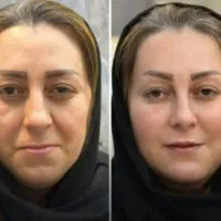 جوانسازی