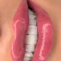 لمینت، کامپوزیت و ایمپلنت اقساط ۲۴ ماه بدون سود