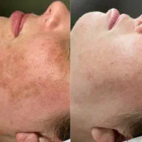 فشیال و پاکسازی تخصصی تخفیف ویژه