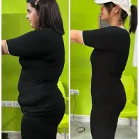 معجزه لاغریRFایکس بادیxbodyکویتیشن|خدمات آرایشگری و زیبایی|اصفهان, شهشهان|دیوار