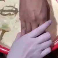 فرمول کرم لکه بردار صورت و دستو پا|آرایشی، بهداشتی، درمانی|رشت, باهنر|دیوار