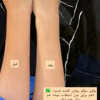 صابون کربن اکتیو|آرایشی، بهداشتی، درمانی|تهران, چیتگر جنوبی|دیوار