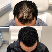 ضمانتم داره