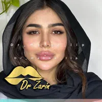 تزریق ژل بوتاکس زاویه فک گونه شقیقه فیلرلب روسی|خدمات آرایشگری و زیبایی|تهران, پونک|دیوار