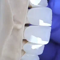 لابراتوار دندانسازی دیجیتال