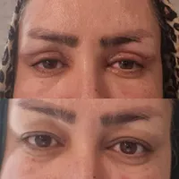 جراحی بینی شیراز /بلفاروپلاستی/ نوبت گیری /وام|خدمات آرایشگری و زیبایی|مرودشت, تامین اجتماعی‎|دیوار
