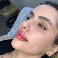 تزریق ژل لب روسی(و با تکنیک M) فیلر و مزوژل