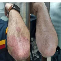 راه حل  تمام مشکلات پوستی