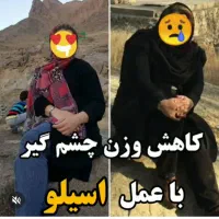 تخفیفات ویژه لیپوماتیک و ابدو و اسلیو اقساطی|خدمات آرایشگری و زیبایی|تهران, میدان ولیعصر|دیوار