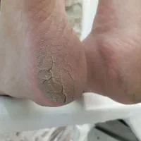 پدیکور تخصصی و خدمات اسپا|خدمات آرایشگری و زیبایی|مشهد, زمانه|دیوار