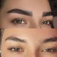 فیبروز، میکرو