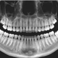 دستیار دندانپزشکی، خانم