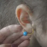 طلای گم شده