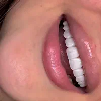 خدمات لمینت و بلچینگ