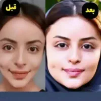 پک چاقی صورت طبیعی و موثر
