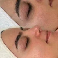 خدمات فشیال(فیشال)پاکسازی دور چشم|خدمات آرایشگری و زیبایی|هشتگرد, هشتگرد قدیم|دیوار