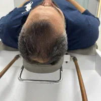 اسکالپ سر هد اسپا