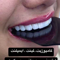 جشنواره اقساطی کامپوزیت