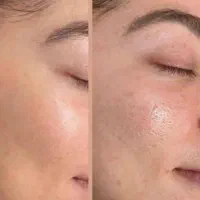مراقبت پوست و مو|آرایشی، بهداشتی، درمانی|شیراز, طلاب|دیوار