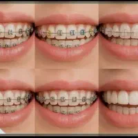 بدون افزایش قیمت(کلینیک دندانپزشکی آرین)