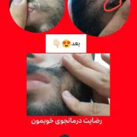 بهبود زگیل/تبخال/hpv/hsv|آرایشی، بهداشتی، درمانی|قم, یخچال قاضی|دیوار