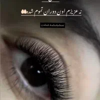اکستنشن تار به تار و کاشت هیدن