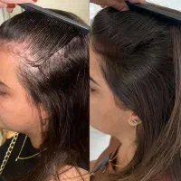 خداحافظی کن با کچلی
