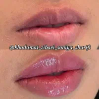 تخفیف ویژه ژل و بوتاکس تا یک هفته|خدمات آرایشگری و زیبایی|اهواز, منبع اب|دیوار