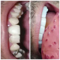 مژده مژده کامپوزیت برای یک ماه  تخفیف ویژه|خدمات آرایشگری و زیبایی|یاسوج, |دیوار