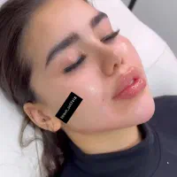 فیلر و ژل انزیم و بوتاکس
