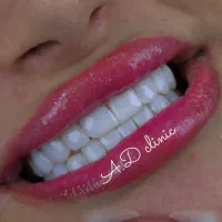 آف ۳ روزه کامپوزیت فکی ۶۸۰۰ اورجینال بلیچینگ