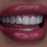 دستیار دندانپزشک