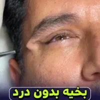 چشمانتان را جوان تر و درخشان تر کنید|خدمات آرایشگری و زیبایی|تهران, جردن|دیوار