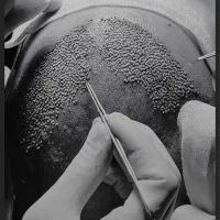 کاشت ابرو و مو با تیم تخصصی در کلینیک معتبر|خدمات آرایشگری و زیبایی|رشت, بوسار|دیوار