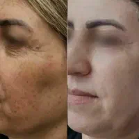 سلامت پوست با تکنولوژی جدید