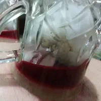 حجامت به روش سنتی ، گرفتن ترس کودک