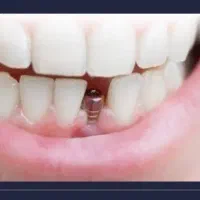 مطب دندانپزشکی شیفت اورژانسی باز است،مرکزاندیمشک