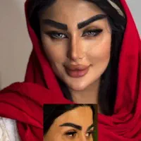 جشنواره جوانسازیMax Lift پزشک پوست مو ژل بینی ابرو|خدمات زیبایی و سلامت|مشهد, هفت تیر (حافظ)|دیوار