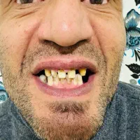 دندانپزشکی|خدمات آرایشگری و زیبایی|قشم, |دیوار